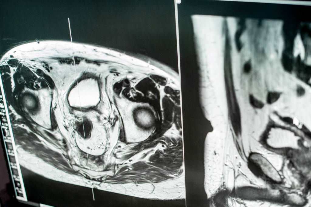 radiographie